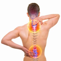 Sténose spinale
